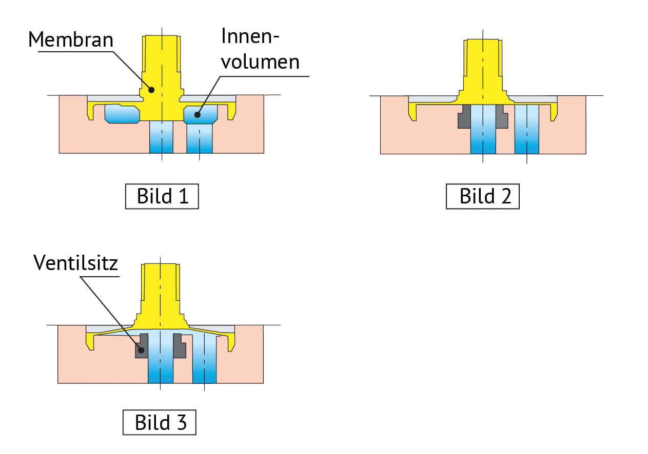 Innenvolumenoptimiert (Zero-Internal-Volume)